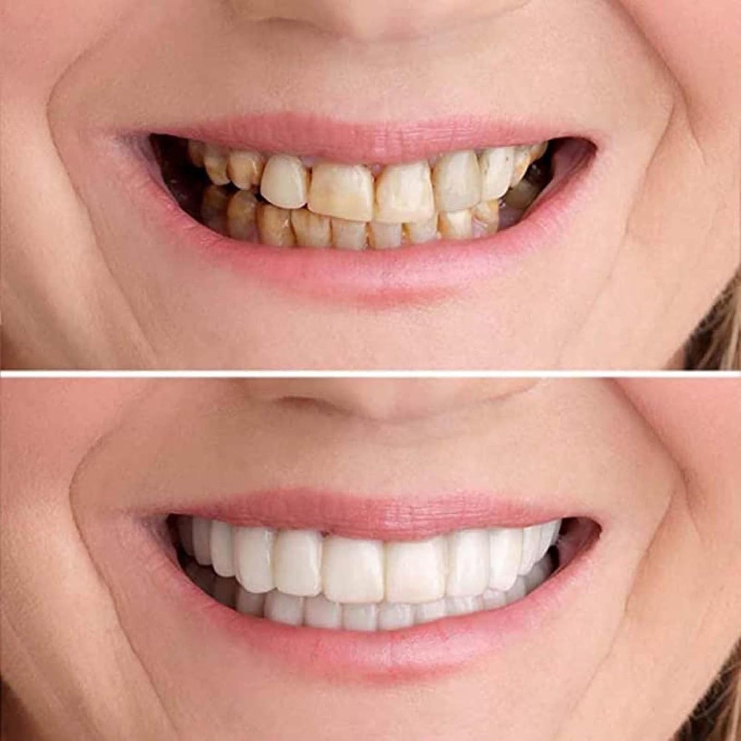 ✨ Recupera tu sonrisa perfecta sin gastar fortunas.