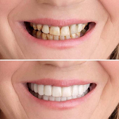 ✨ Recupera tu sonrisa perfecta sin gastar fortunas.
