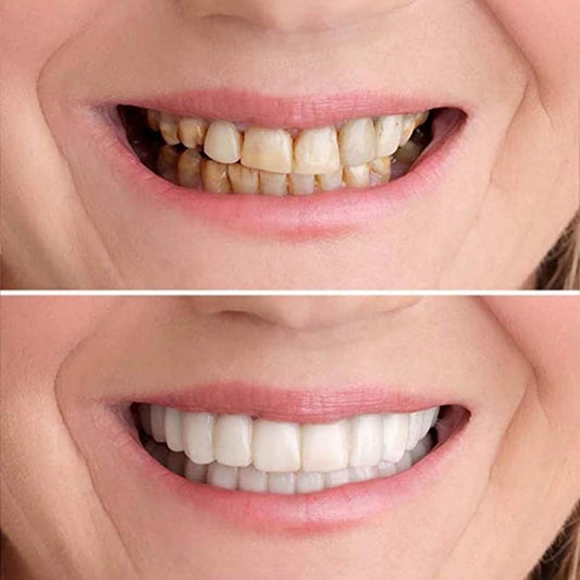 ✨ Recupera tu sonrisa perfecta sin gastar fortunas.
