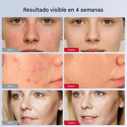 Máscara de luz LED, para la cara, 7 colores de luz roja, dispositivo de cuidado facial en casa, portátil, inalámbrico y recargable